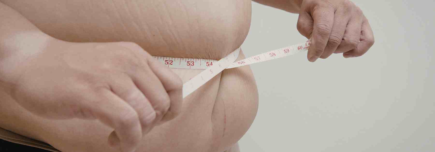 Obese stomach before using weight loss injections